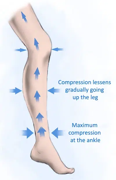 How to compression socks work