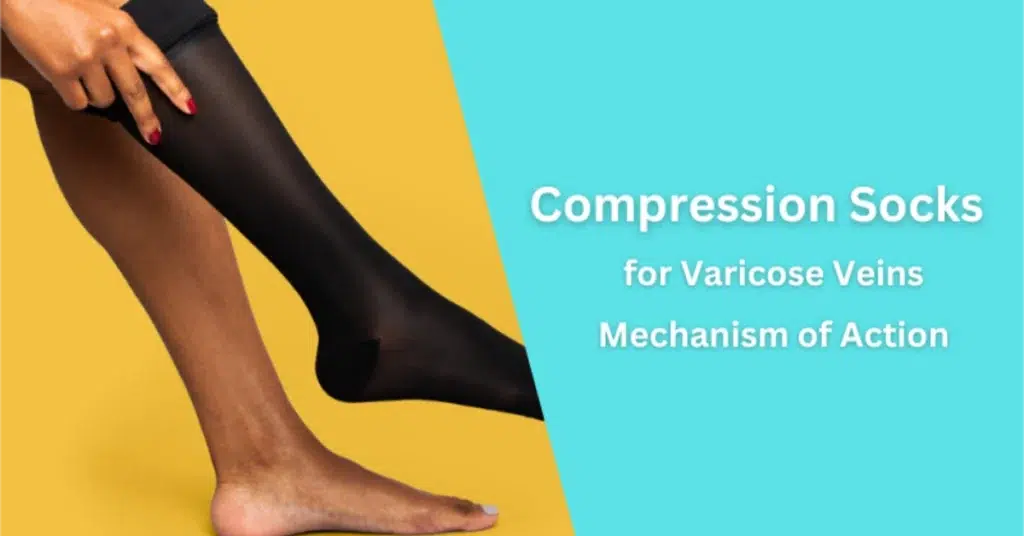 compression socks for varicose veins mechanism of action