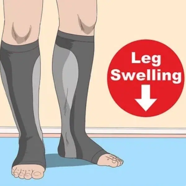 Wear compression socks to reduce Post Operative Swelling