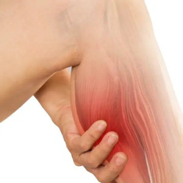 delayed onset muscle soreness DOMS